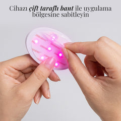 Ossigeno FlexPure FLEX415 çift taraflı bant ile uygulama bölgesine sabitleme – görsel 5