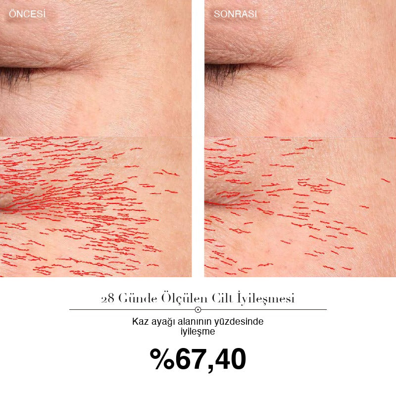 SkinLift Pro 28 günlük ölçüm: kaz ayağı alanının yüzdesinde %67,40 iyileşme — öncesi ve sonrası